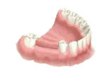 2 dents manquantes
